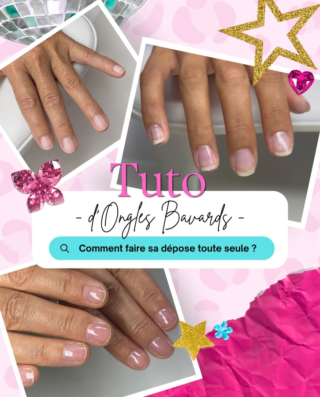 Ongles Bavards