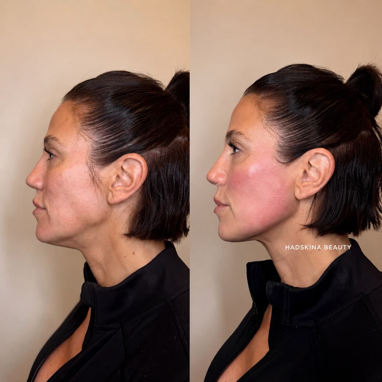 Hadskina Beauty
