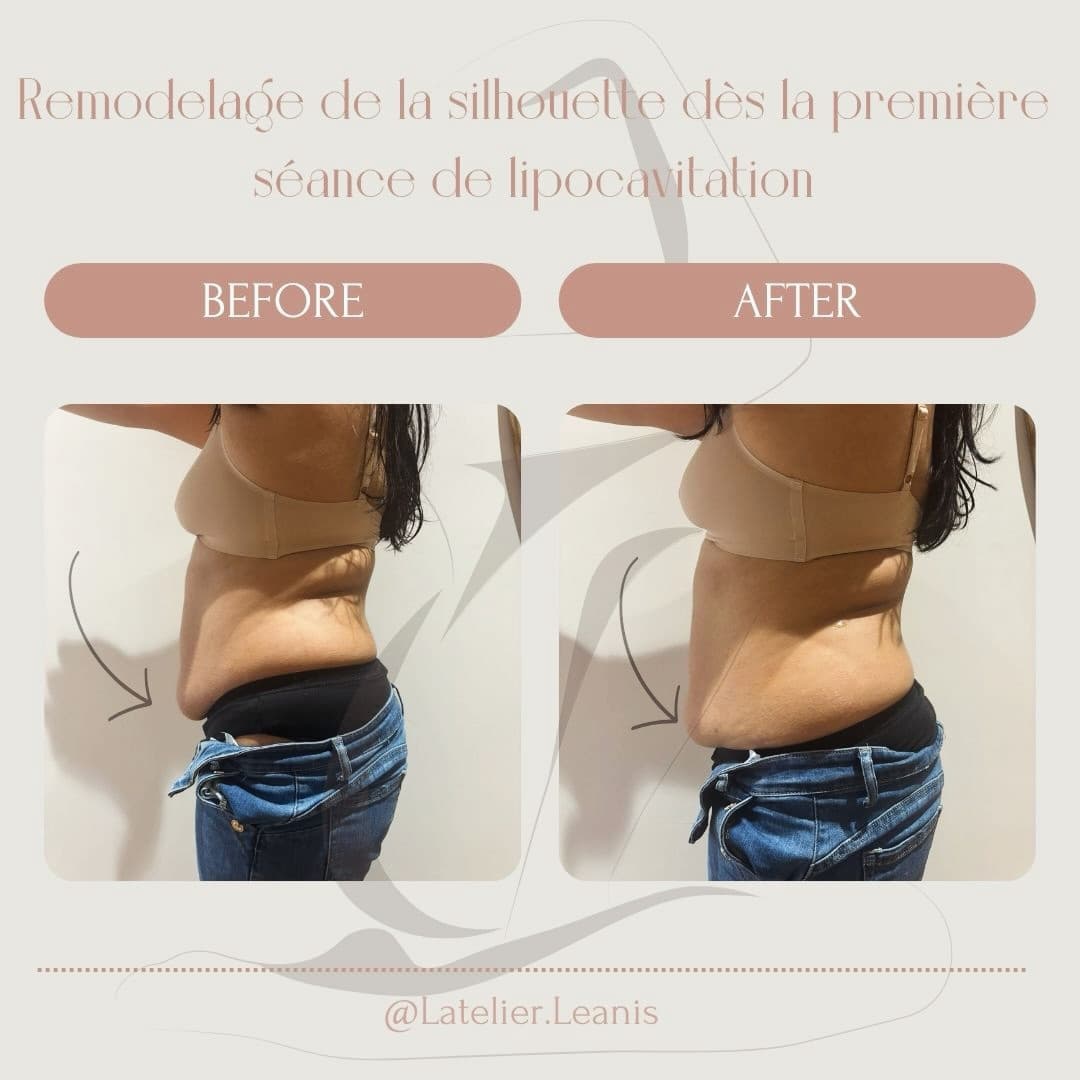 L'atelier Leanis